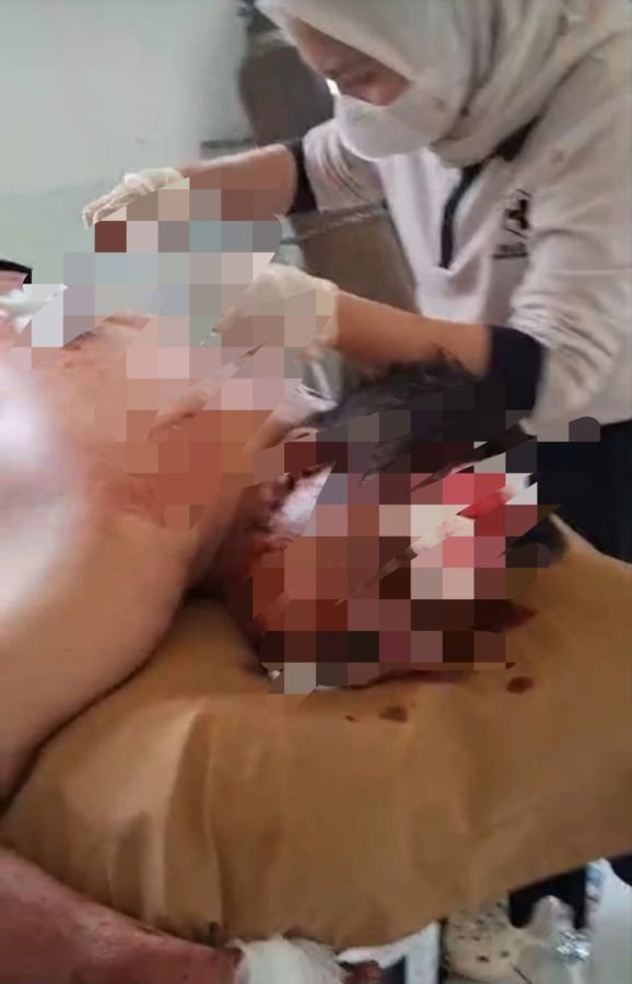 Sengketa Kebun Berujung Kekerasan, 11 Orang Luka: Kuasa Hukum Desak Polisi Bongkar Dalang